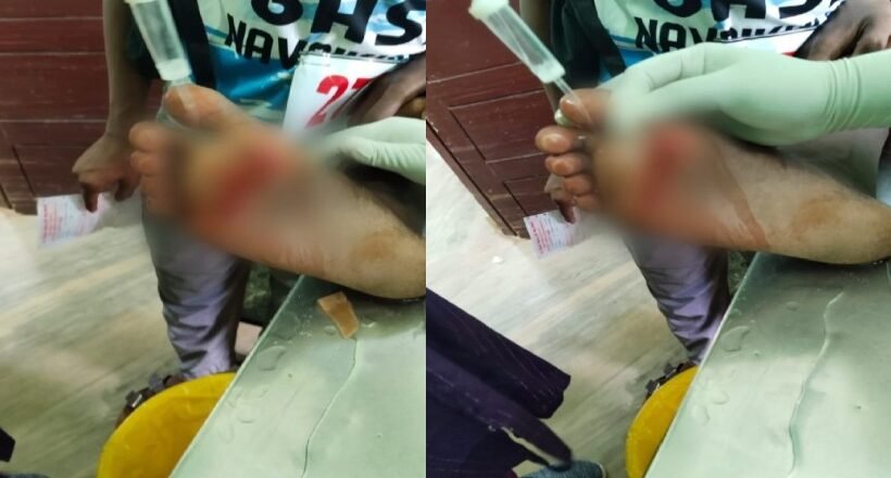 തിരുവനന്തപുരം കിളിമാനൂർ ഉപജില്ലാ സ്കൂൾ കലോത്സവത്തിനിടെ ഗുരുതരവീഴ്ച